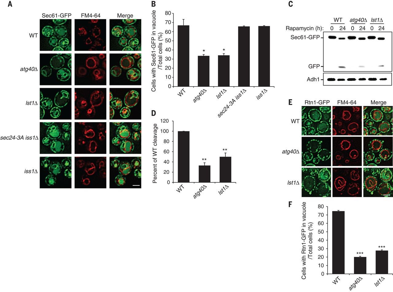 Fig. 1 Lst1 is required for ER-phagy.